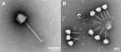 Isolation and in vitro characterization of novel S. epidermidis phages for therapeutic applications